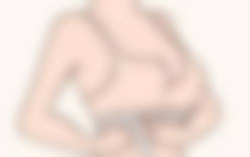 隆胸修复期是多长时间：注射隆胸1 - 2周的极速回归体验