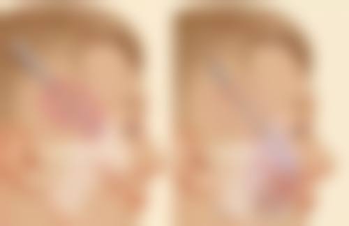 怎么把儿童眼睛睡成双眼皮：安心温和的呵护之道