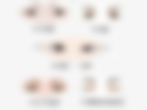 做完线提升后晚些做面部吸脂的好处:等待的艺术之美