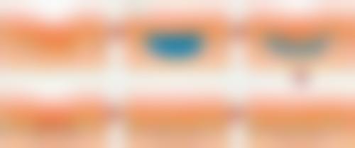 赴韩整形的主要风险陷阱