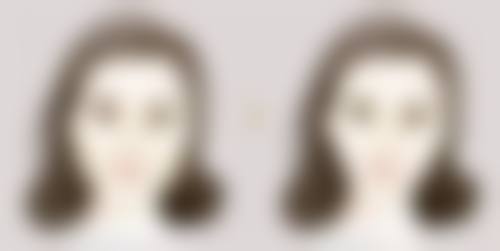 玻尿酸隆鼻一次能保持多久：6 - 8个月的“快速体验装”