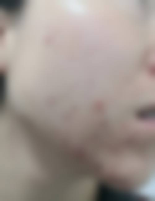 韩国jfeel皮肤科怎么样，抖音团购活动及价格表