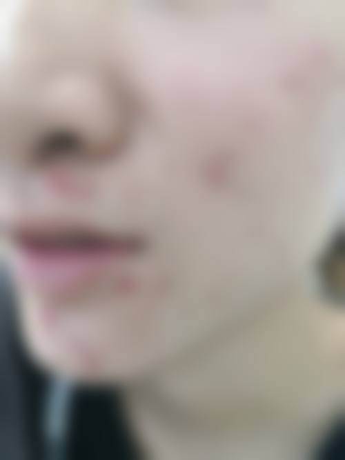 东莞赛伊雅医疗美容诊所怎么挂号，地址在哪儿