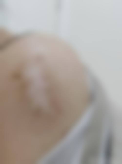 长岭县大上海美容诊所更擅长什么手术