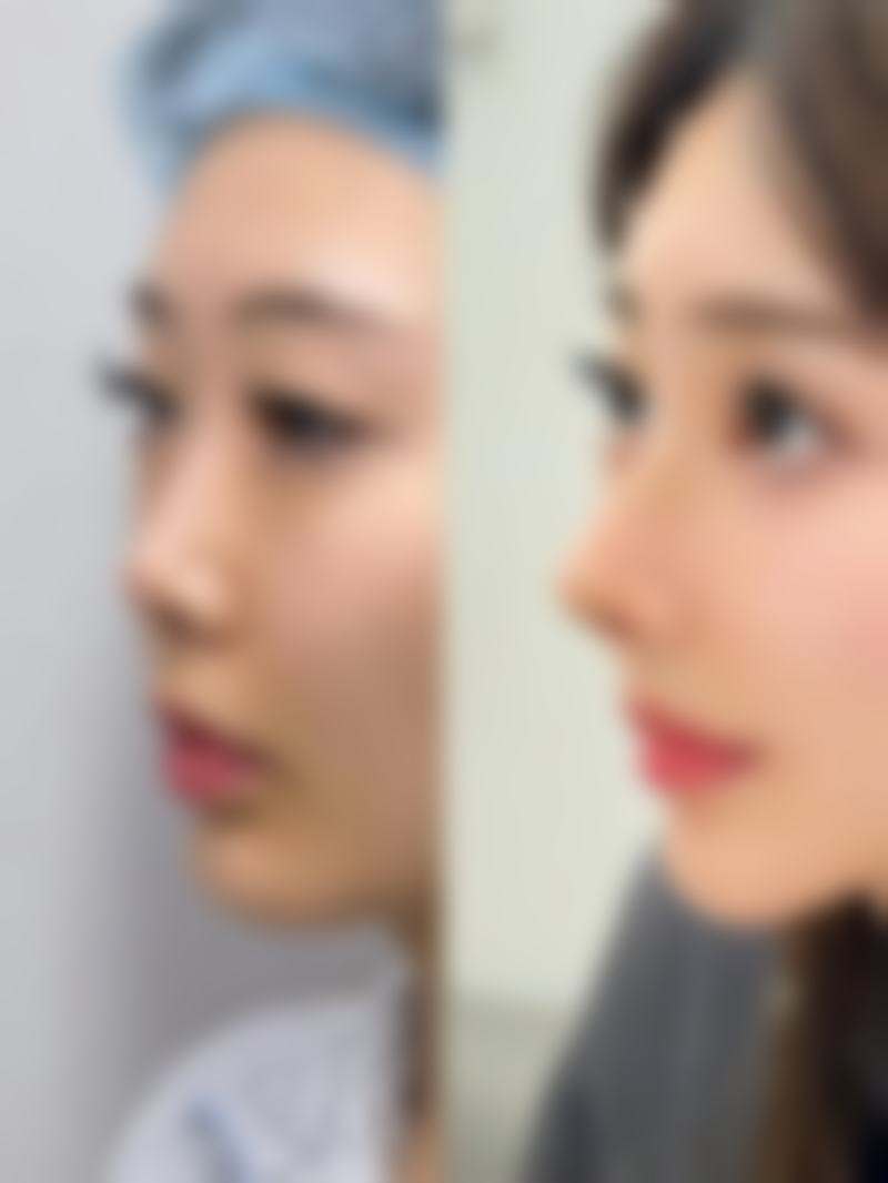 快餐式赴韩医美流行