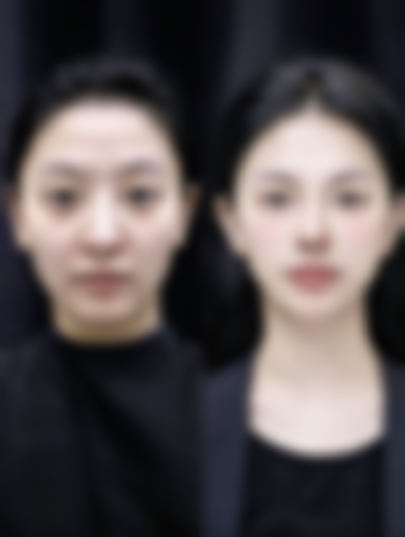 耐心与坚持是美丽的关键