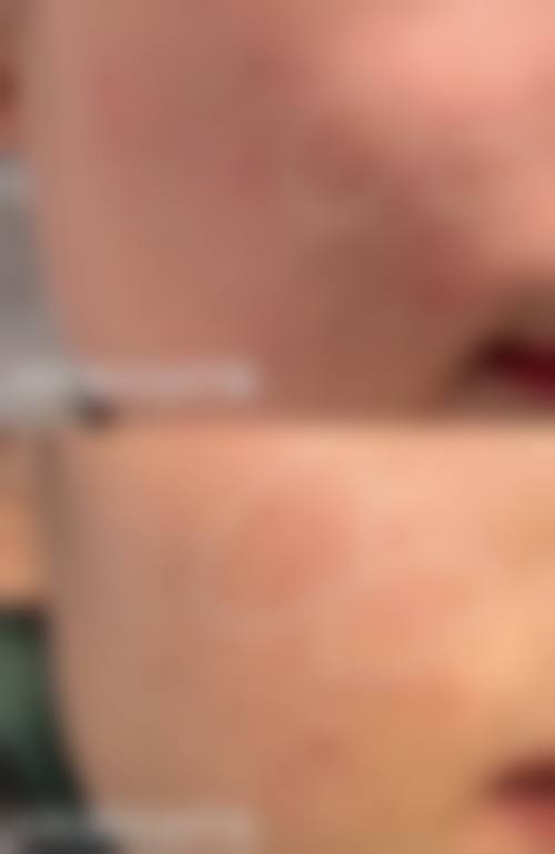 张宇航医生怎么挂号