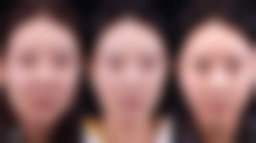 割双眼皮会遗传给下一代吗——自然遗传概率的奇妙之旅