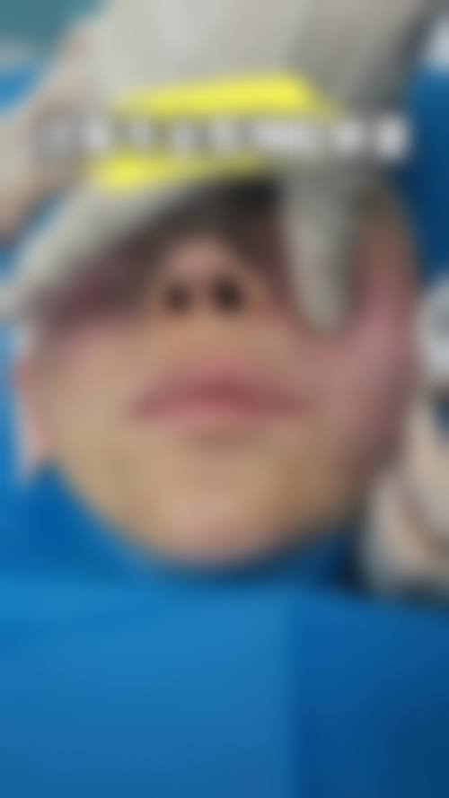 邯郸兰积整形医院项目特色