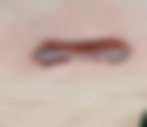 邹海滨医生怎么挂号