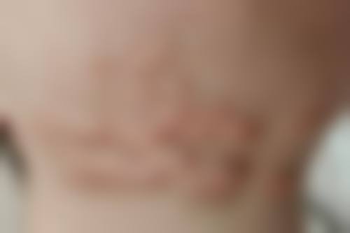 大连航天医院疤痕整形科口碑好不好？附真实患者口碑评价