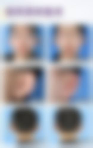 广州壹加壹整形医院项目特色