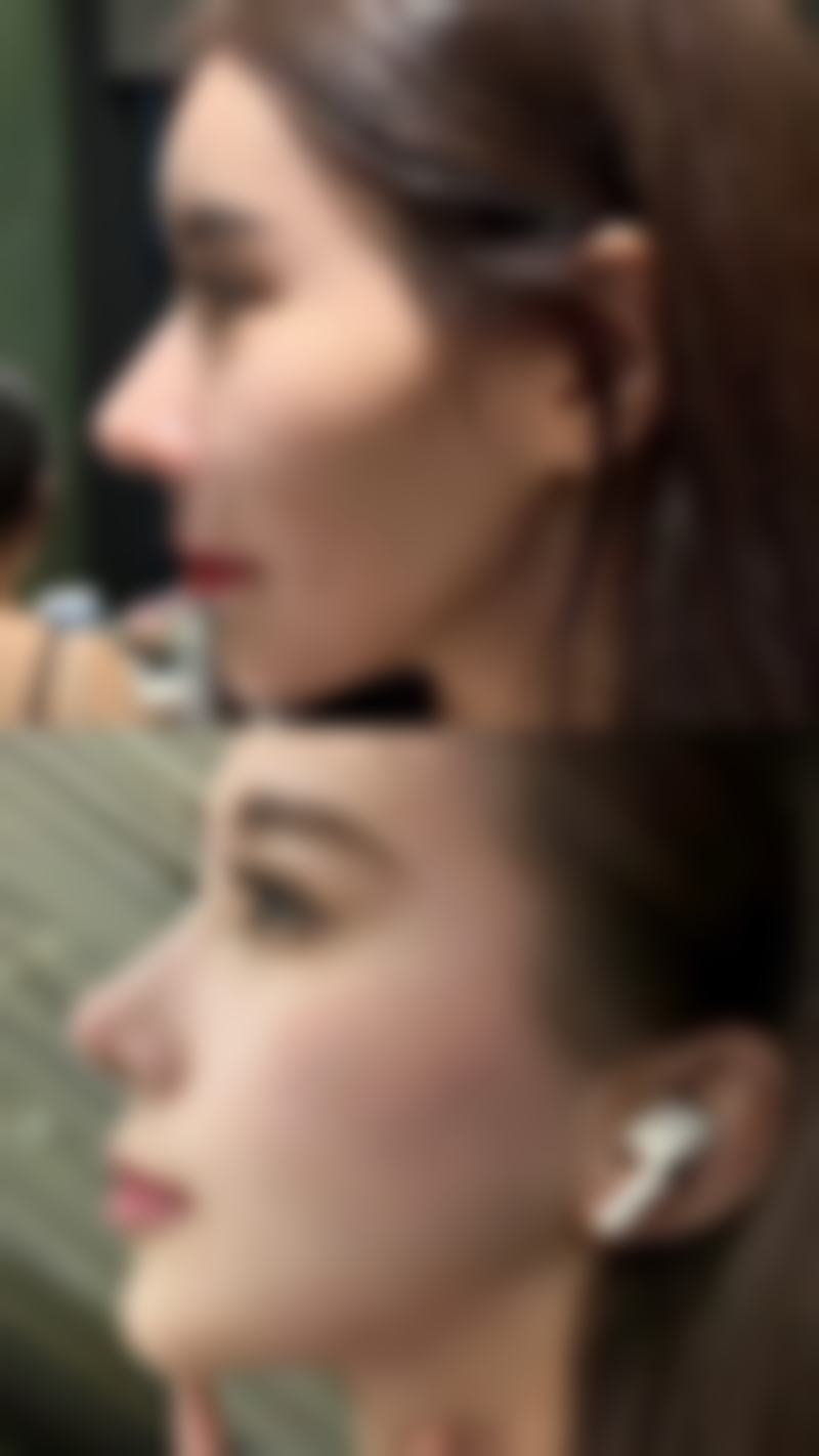 西安御美医疗美容医院怎么样，口碑评价如何？