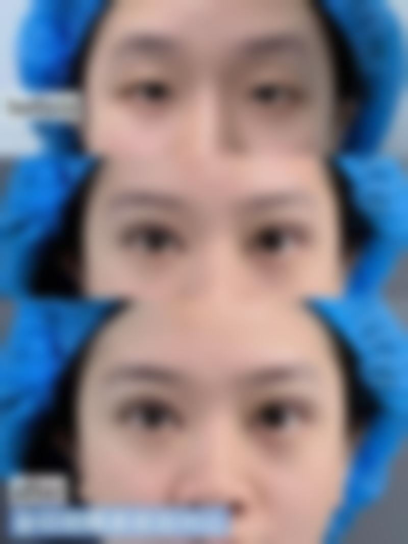 孝感缘临医疗美容门诊部特色项目有哪些