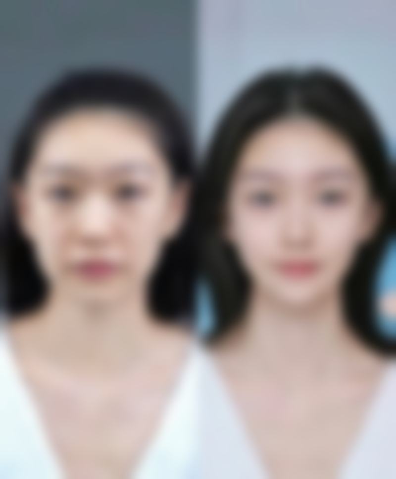 艾诺疤痕修复资质是否正规——证照齐全有保护