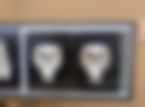 割双眼皮会遗传给下一代吗——双眼皮遗传的其他有趣事实