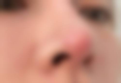 青岛洋美医疗美容诊所评价