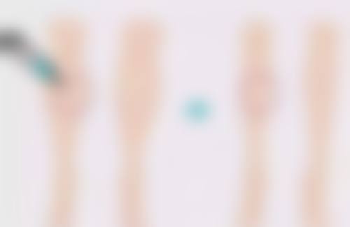 自体脂肪移植隆胸的成效好吗:安心性与风险把控