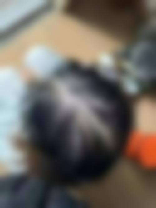 长沙科发源植发整形的服务情况