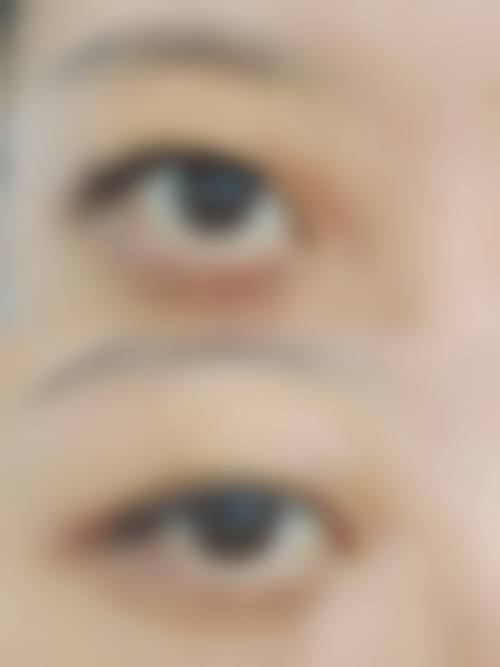 长沙科发源植发整形口碑好不好