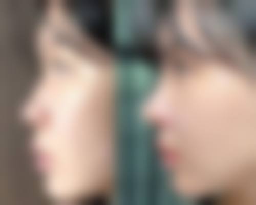 青岛洋美医疗美容诊所价格表