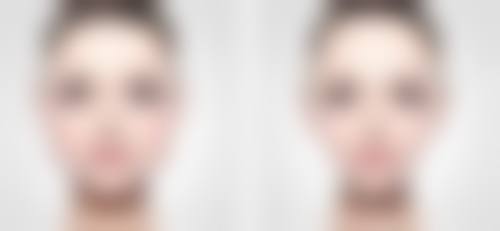 发际线多久可以二次种植:影响时间的关键因素大揭秘