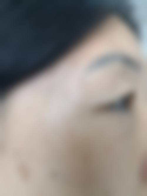 烟台上美整形医院价格表