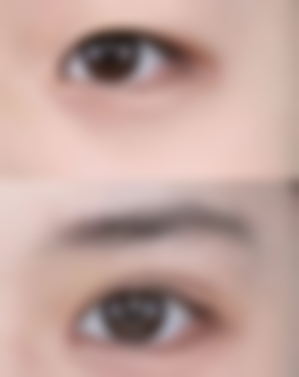 黄梓涵医生项目优势