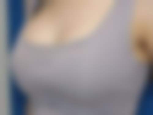 上海馨仕丽医疗美容诊所真人口碑评价怎么样？