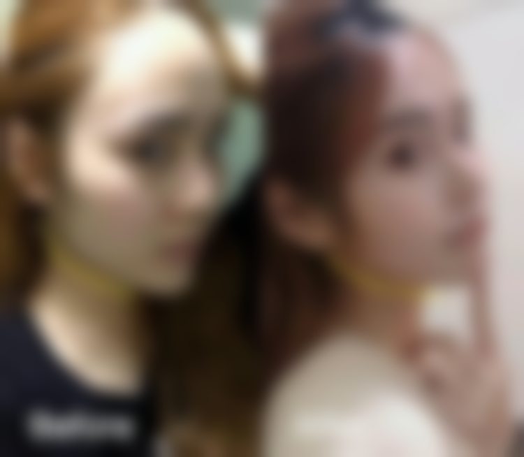杭州连天美医疗美容医院李文鹏价格透明性价比优