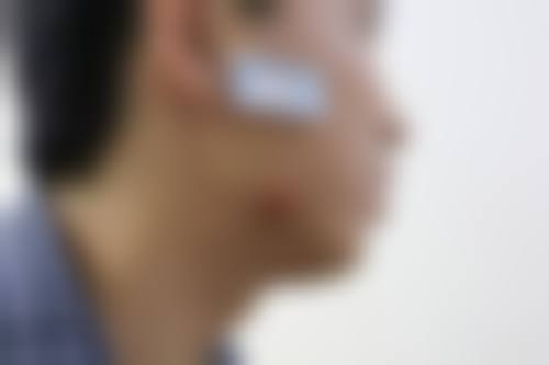 罗日云医生怎么挂号