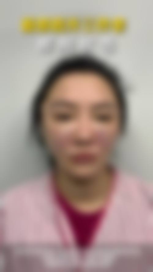 阜阳陈爱宁整形医院价格表