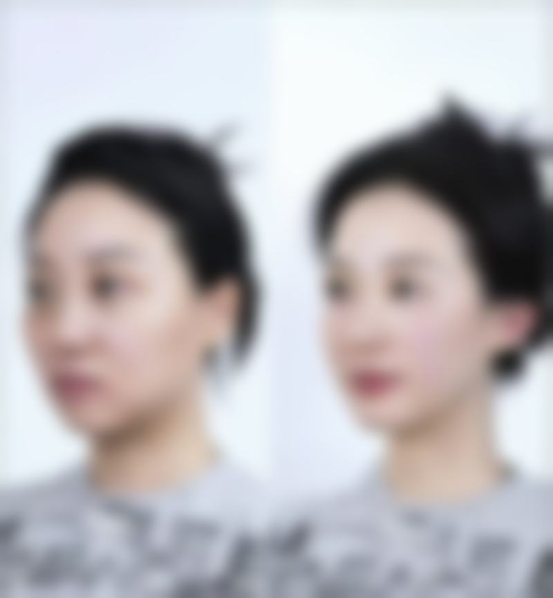 武汉臻妍颂医疗美容门诊部价格表