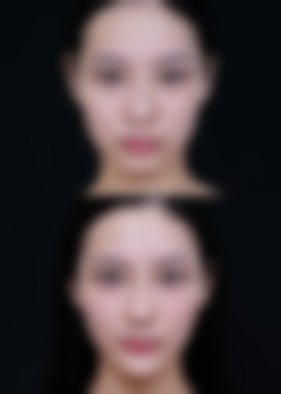 七、韩国首尔BK东洋整形医院合作医院怎么样口碑好不好？附真实患者口碑评价