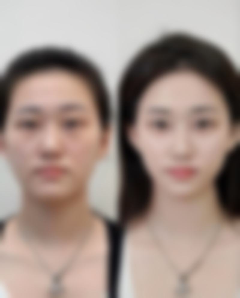 阜阳陈爱宁整形医院项目特色