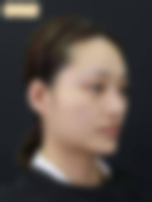 武汉荟丽医疗美容门诊部顾客实例