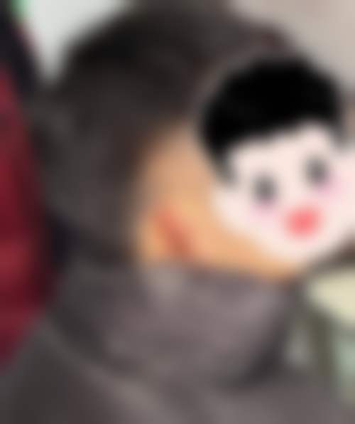 韩长久医生简介项目优势