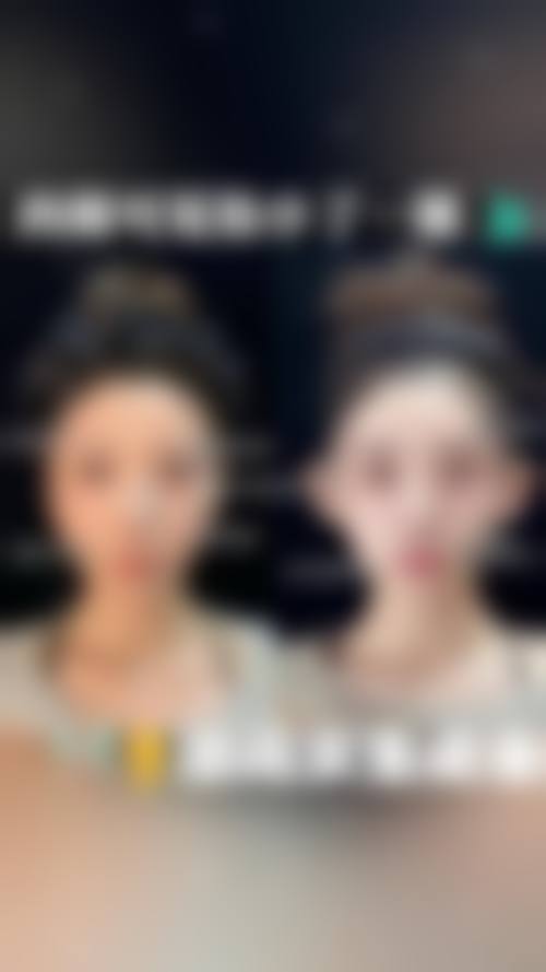 深圳容术医疗整形美容上班时间及地址