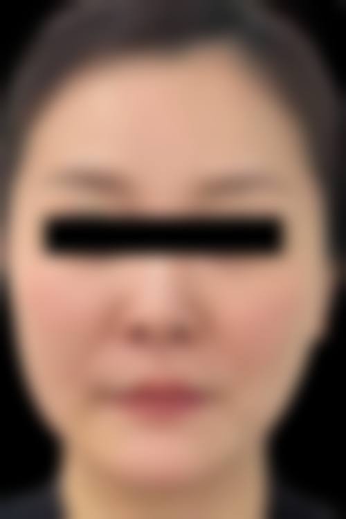成都悦龄美之肤医疗美容医生优势