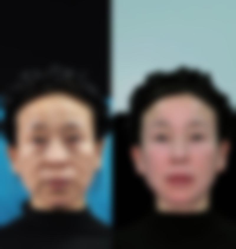沧州奥拉克医疗美容医院口碑评价如何?