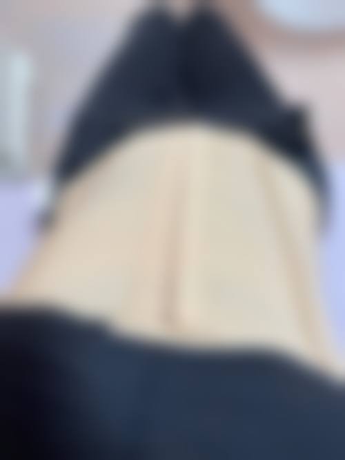 朱院长医生做手术价格