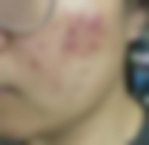 济南悦美医疗美容诊所怎么样，评价