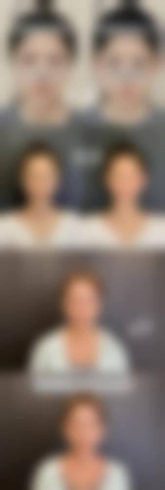 德阳东美奥拉克医疗美容整形门诊部顾客实例