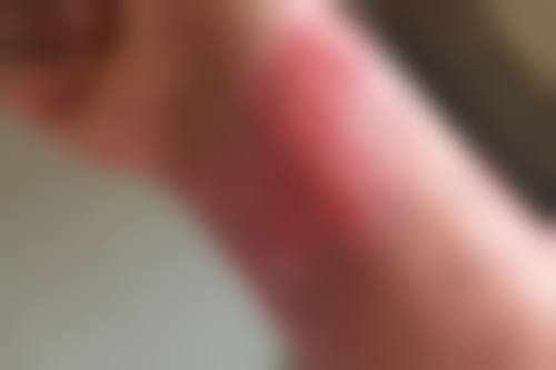 永济臻颜医疗美容诊所可靠吗
