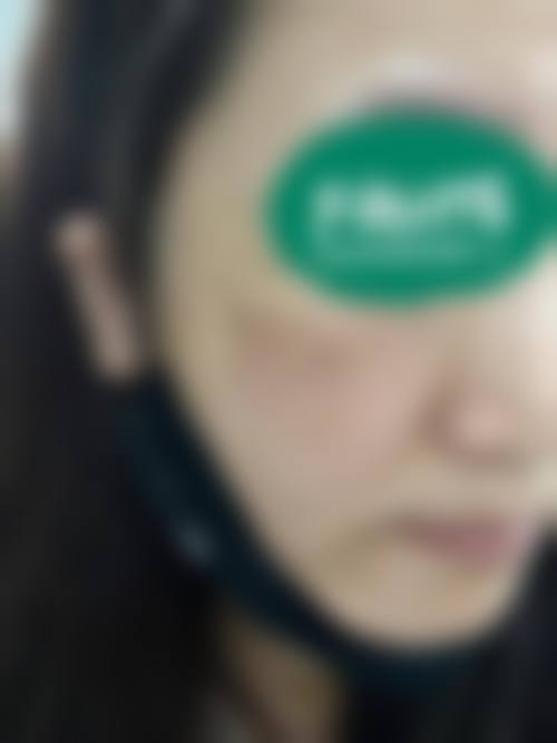 永济臻颜医疗美容诊所价格表
