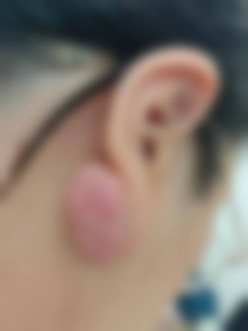 九江华美整形医院价格表