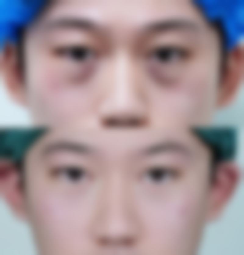 韩国皮肤科挤满医美的国内人，浪漫江南提供便捷沟通