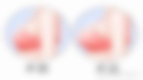 赖启煜医生顾客实例图片