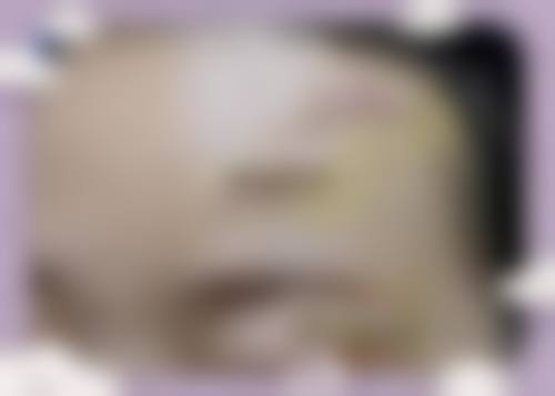 无锡奥罗拉医疗美容门诊部价格表