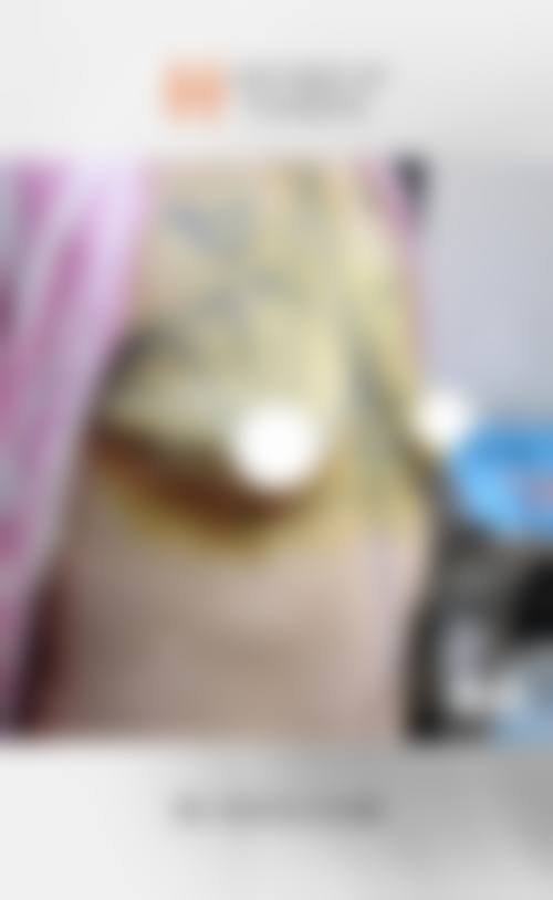 临汾佳美医疗整形门诊部更擅长什么